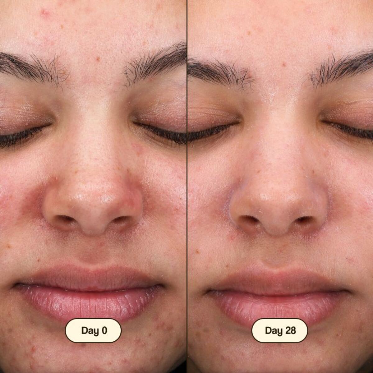 Limpiador Facial Salicylic Fresly 100ml