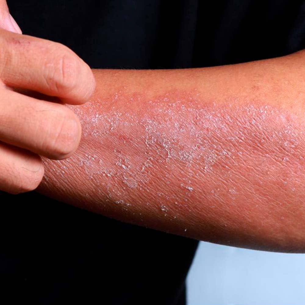 Jabón Natural Centella Asiática Y Rosa Mosqueta 90g - Calma Pieles Con Dermatitis, Psoriasis O Muy Secas - Cicatrizante_4
