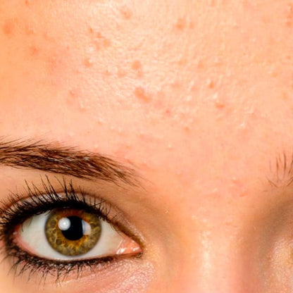 Pack 10 Jabón Natural Exfoliante Limón - Regula El Nivel De Grasa - Evita El Acné Y Aclara Sus Marcas - Exfoliante Suave_4