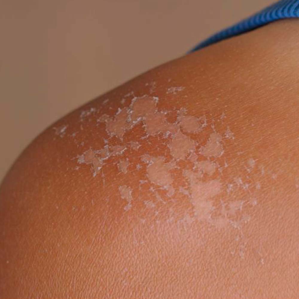 Jabón Natural De Caléndula (90g) - Calma La Piel Seca, Con Dermatitis E Irritaciones - Cicatriza Y Alivia Quemaduras_3
