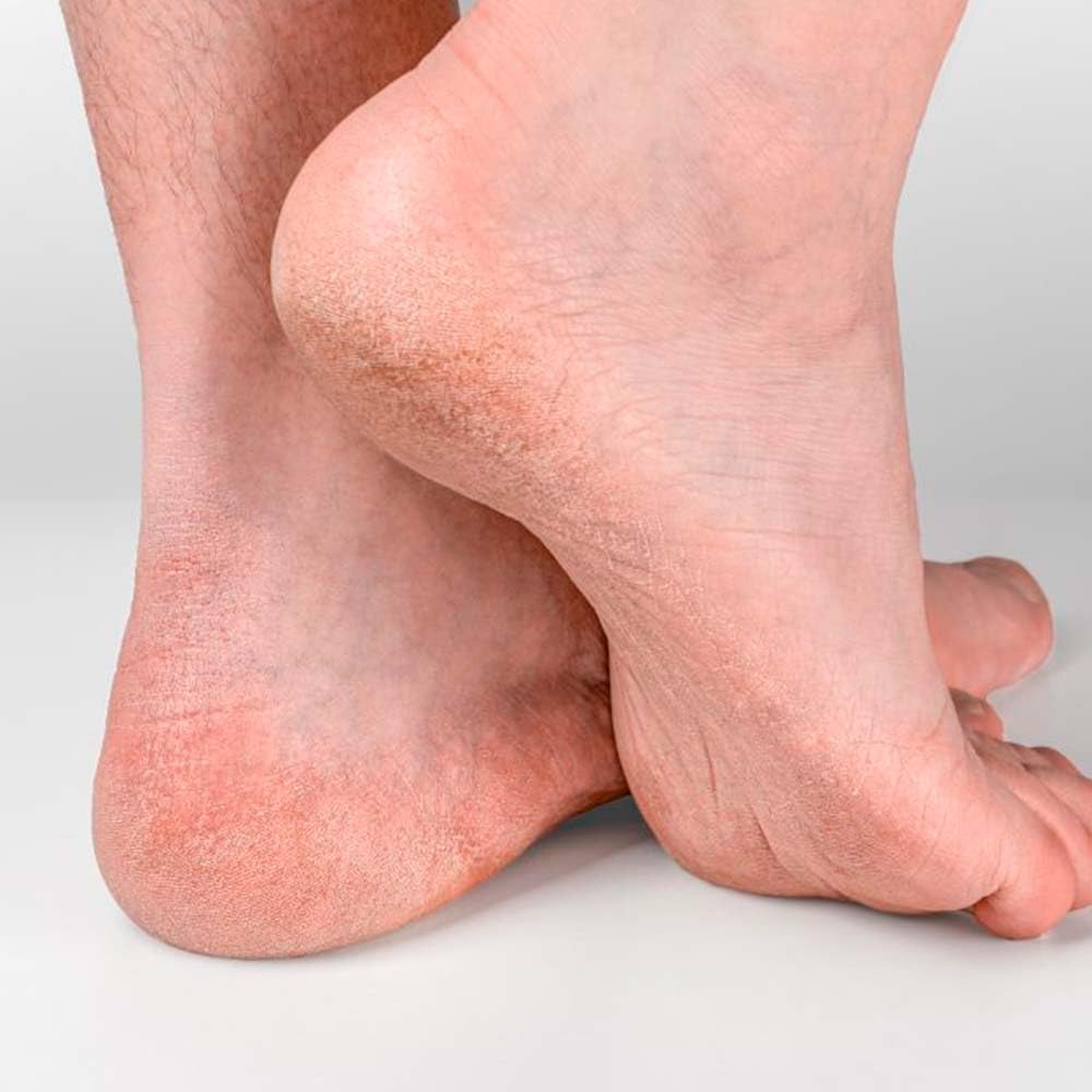 5 Jabón Natural Exfoliante Piedra Pómez - Reduce Durezas En Talones, Rodillas, Manos Y Codos - Exfolia Y Nutre La Piel_3