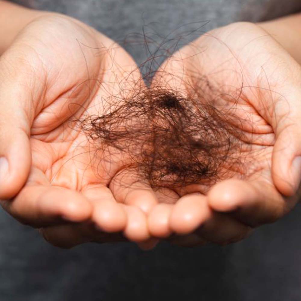 Champú Sólido Anticaída y Fortalecedor - 100% Natural - Todo Tipo de Cabello - Con Aceite de Ricino - 1 ud._1