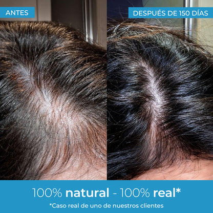 Strength Loción crece pelo Arganour 50ml
