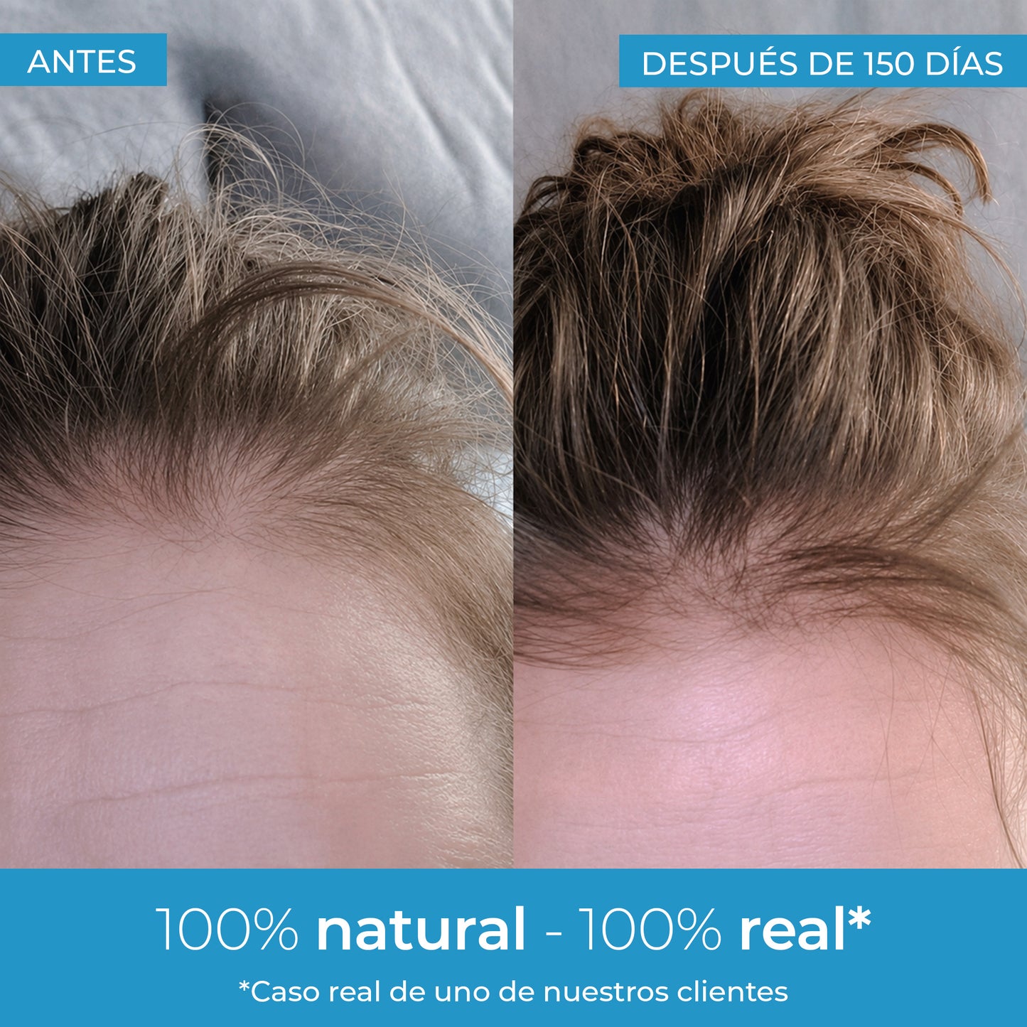 Strength Loción crece pelo Arganour 50ml
