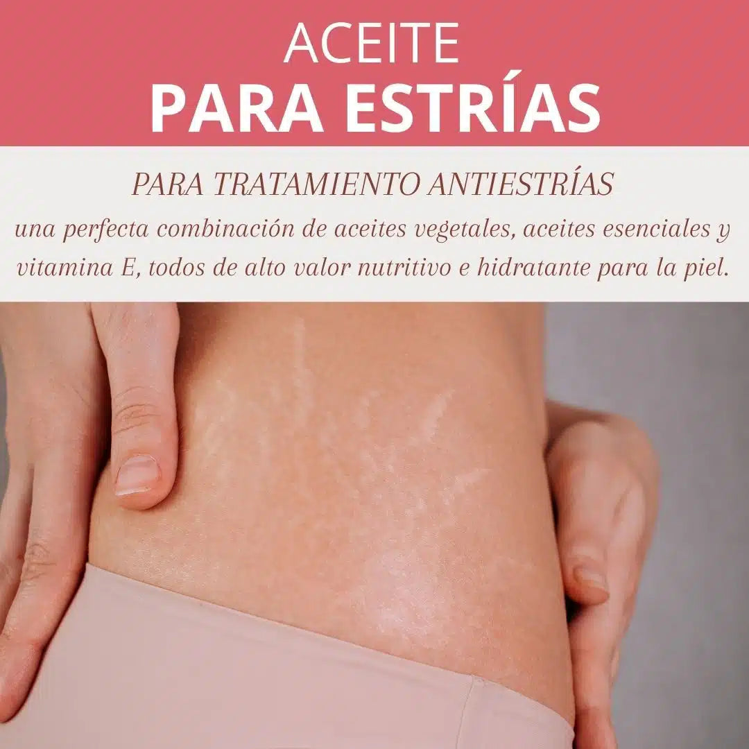 QKnatur - Aceite Antiestrías 250 Ml. Con Rosa Mosqueta - Ayuda A Reducir Y Prevenir La Apariencia De Cicatrices_1