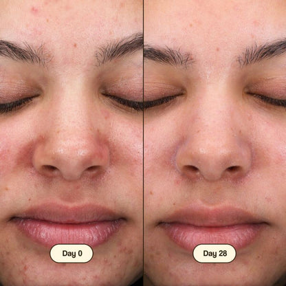 Limpiador Facial Salicylic Fresly 100ml